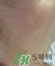 skin1004是什么牌子？skin1004属于什么档次