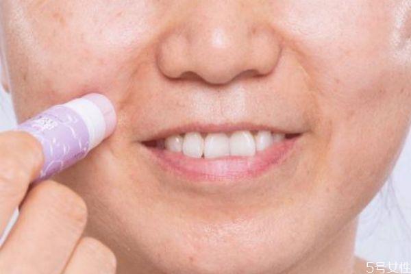 怎么去除嘴角皱纹 去除嘴角皱纹的方法