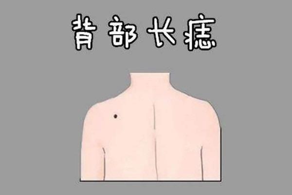 探秘女人10处有痣是富贵痣，女人身上那些地方有痣是富贵痣  7