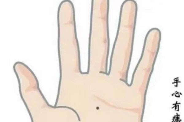 探秘女人10处有痣是富贵痣，女人身上那些地方有痣是富贵痣  8