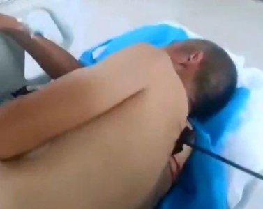 ​山东临沂多人遭弓箭射中，受伤画面曝光！镇政府：嫌犯已被抓_ZAKER新闻