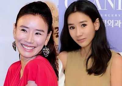 ​佩服！10位韩国女星整容前后对比，在韩国整容跟化妆一样正常？