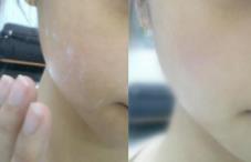 去角质凝露哪些人不能用?痘痘肌别用 去角质凝露哪些人不能用?痘痘肌别用