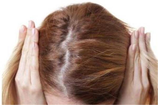 脱发是缺少什么维生素 脱发是什么原因导致的 脱发是缺少什么维生素 脱发是什么原因导致的