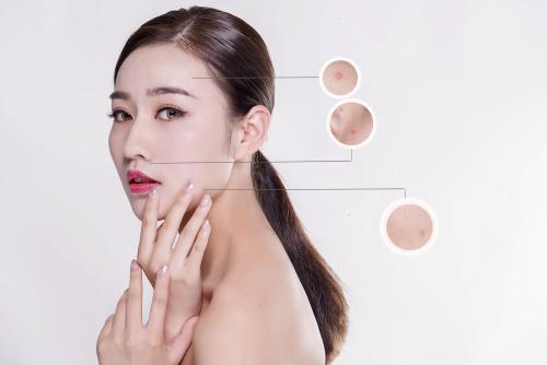 脸部死皮多是怎么回事 脸部死皮怎么去 脸部死皮多是怎么回事 脸部死皮怎么去