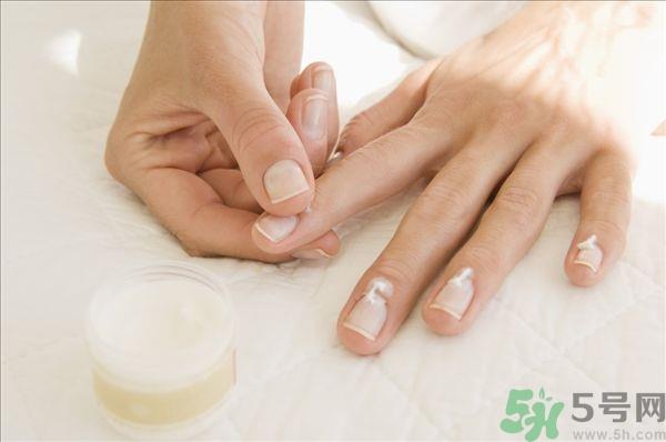 冻疮初起怎么处理 冻疮初期怎么治