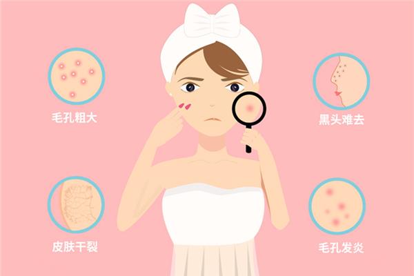 黑头要定期清理吗 黑头多久清理一次比较好 黑头要定期清理吗 黑头多久清理一次比较好