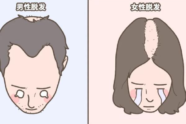 掉发有白色颗粒是什么 掉发有白色毛囊还会在长吗 掉发有白色颗粒是什么 掉发有白色毛囊还会在长吗